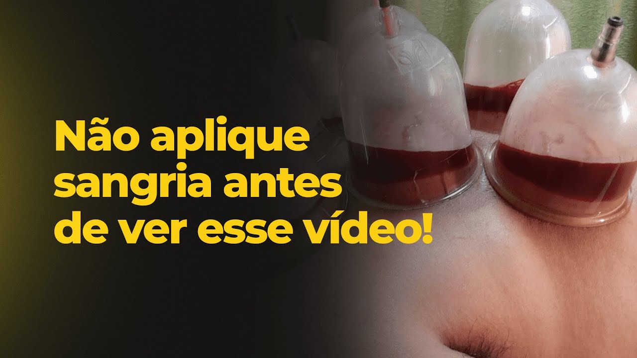 Sangria com Ventosa: Guia prático de aplicação da Técnica de Sangria nos seus pacientes