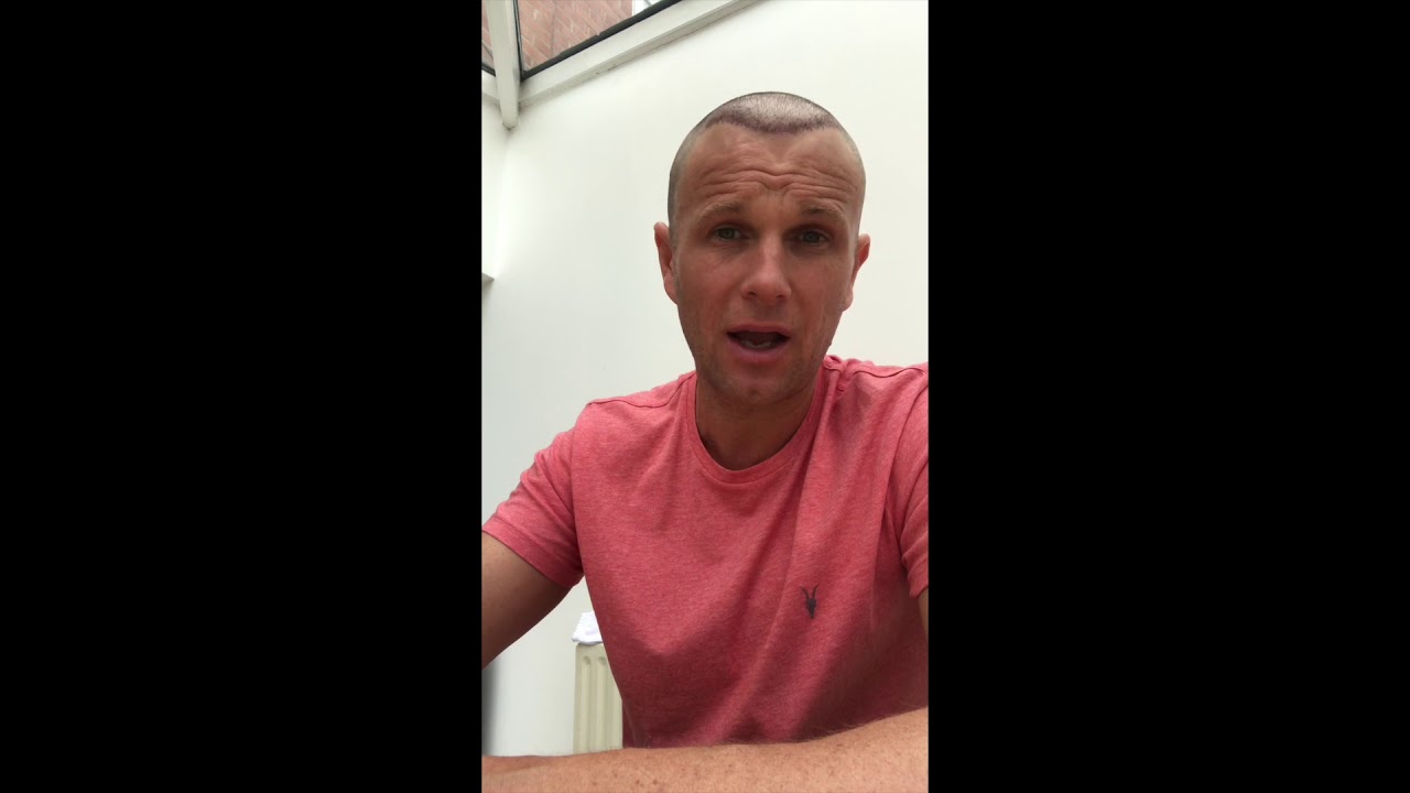Spex Hair Transplant at The Harley St Hair Clinic post op update