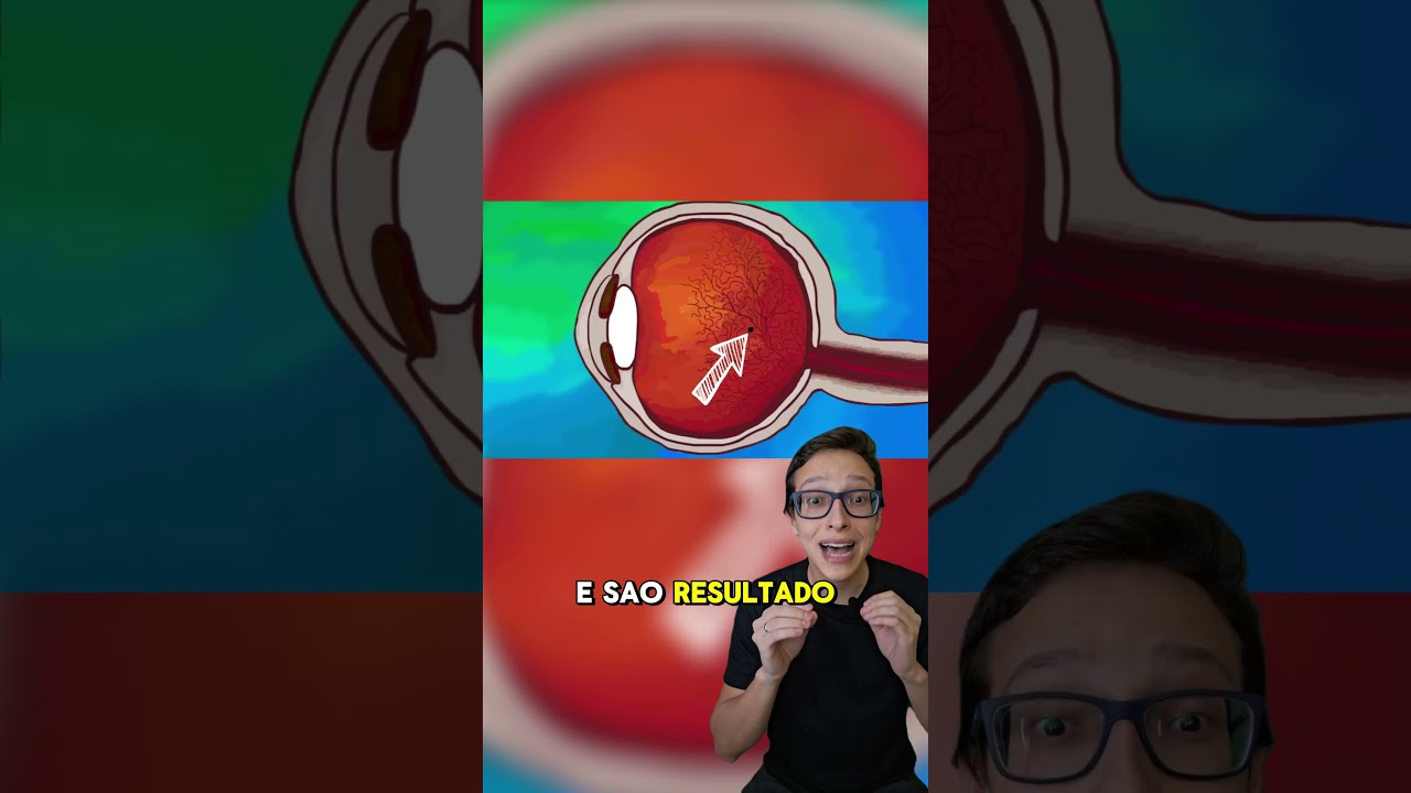 Moscas Volantes 😱#medicina #medico #enfermeira #enfermagem #olhos #oftalmologia #oftalmologista olho