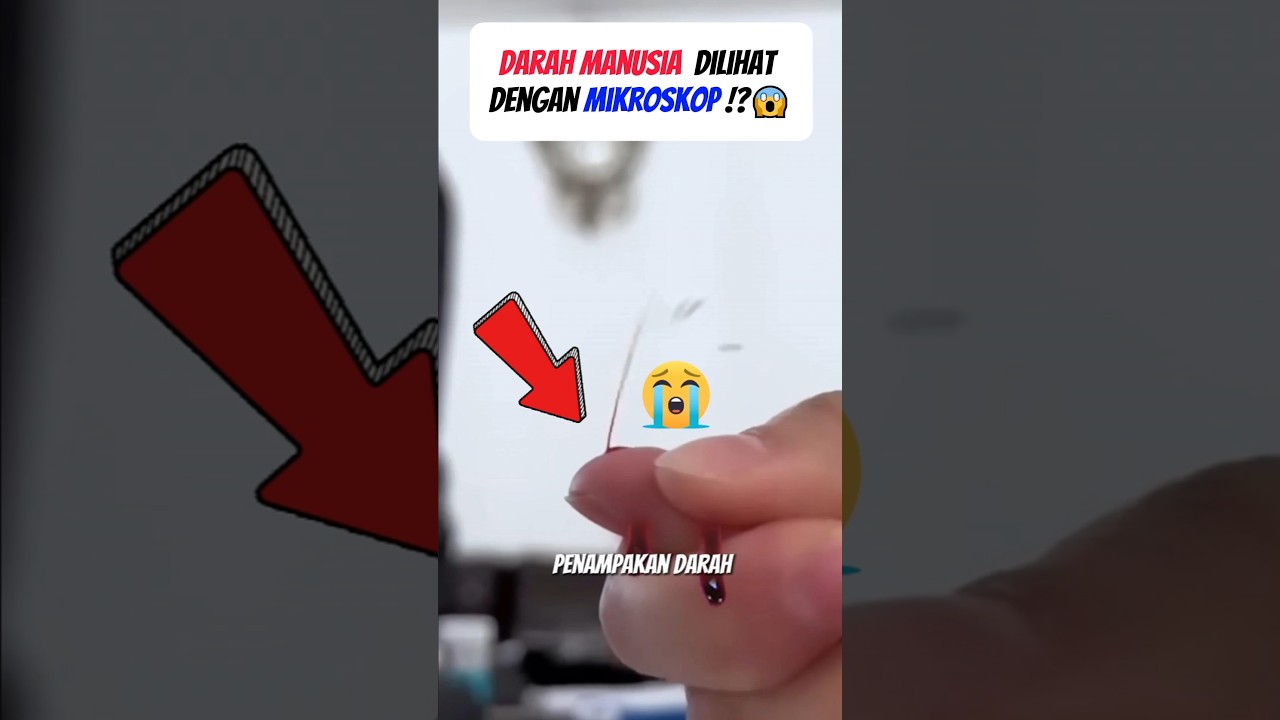 DALAMNYA DARAH?! Pas Dilihat Pakai Mikroskop, Bikin Merinding! 😨🧬🔍#shorts