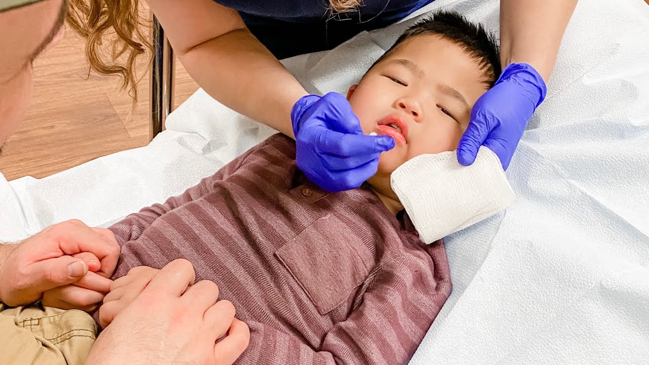 Our Toddler Bit Through His Lip! 😢