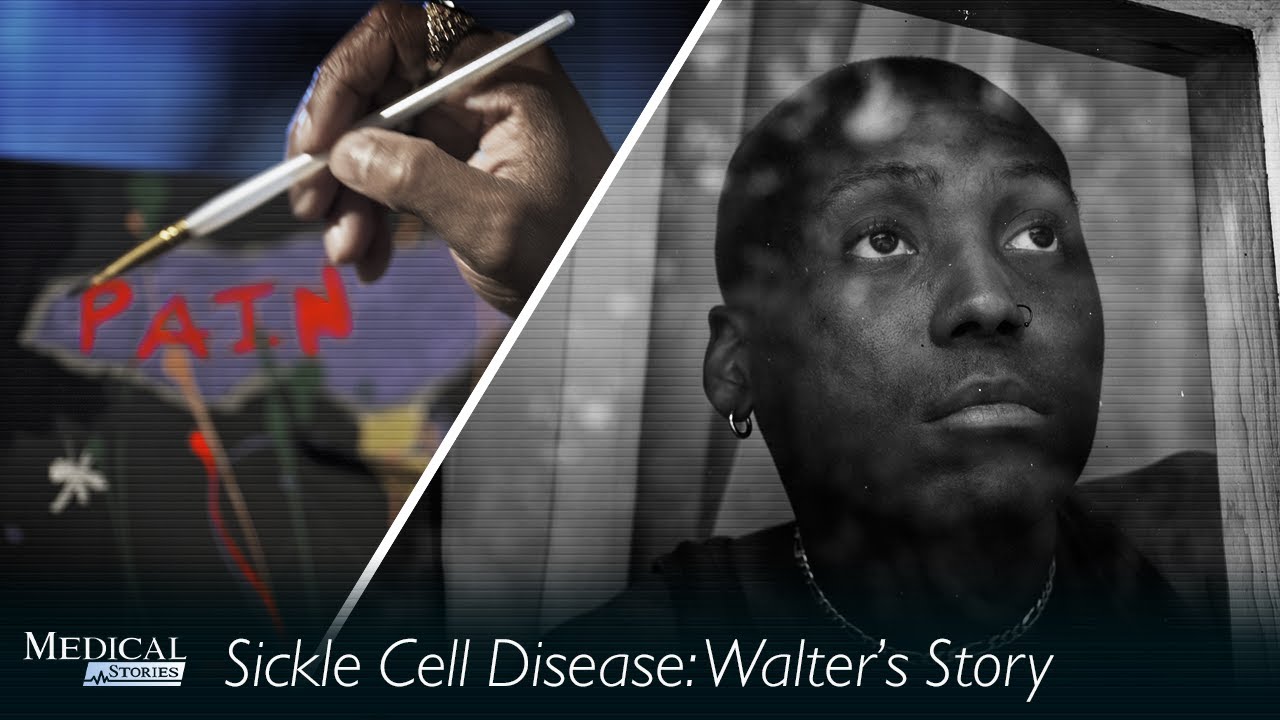 Medical Stories - Sickle Cell: Walter&rsquo;s Story