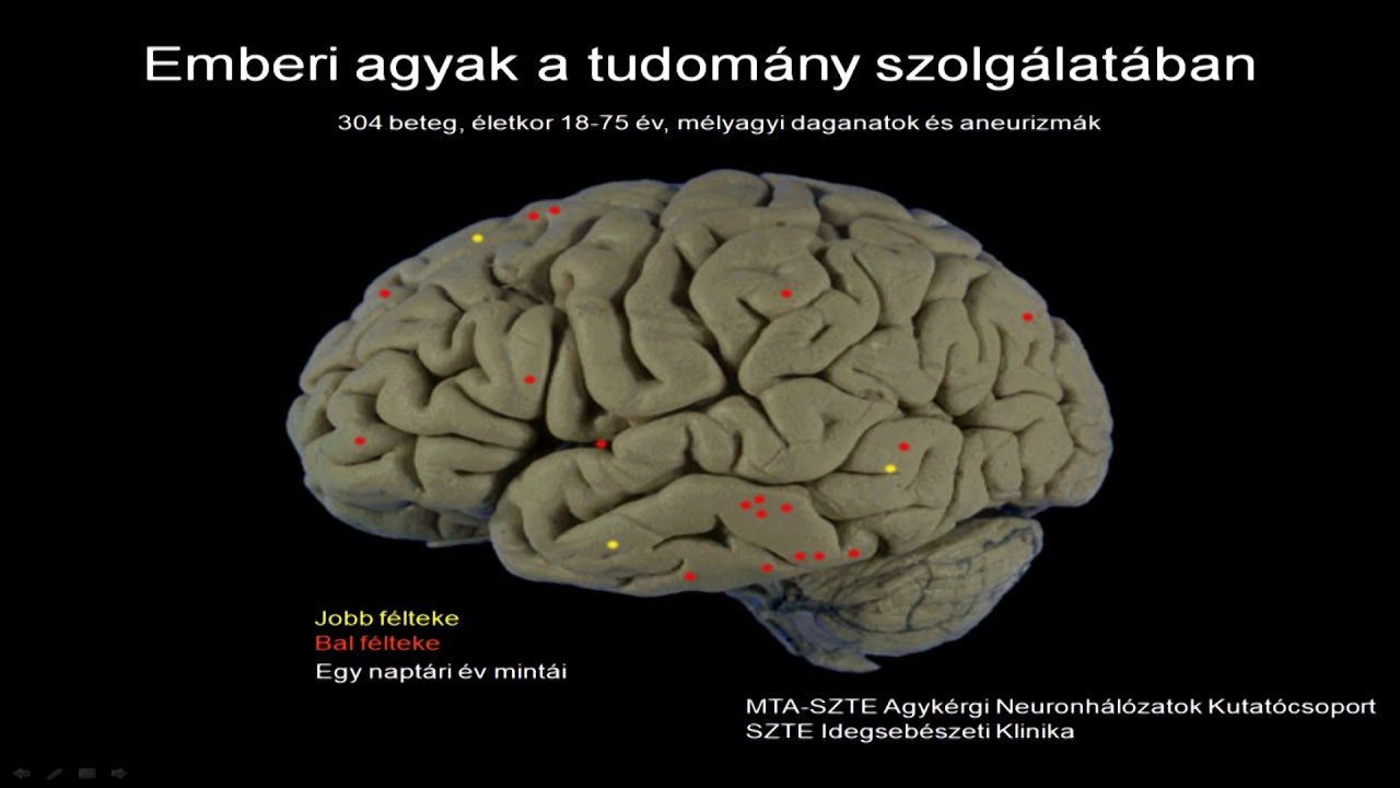 Prof. Dr. Tamás Gábor: Mi teszi az agyunkat emberivé?