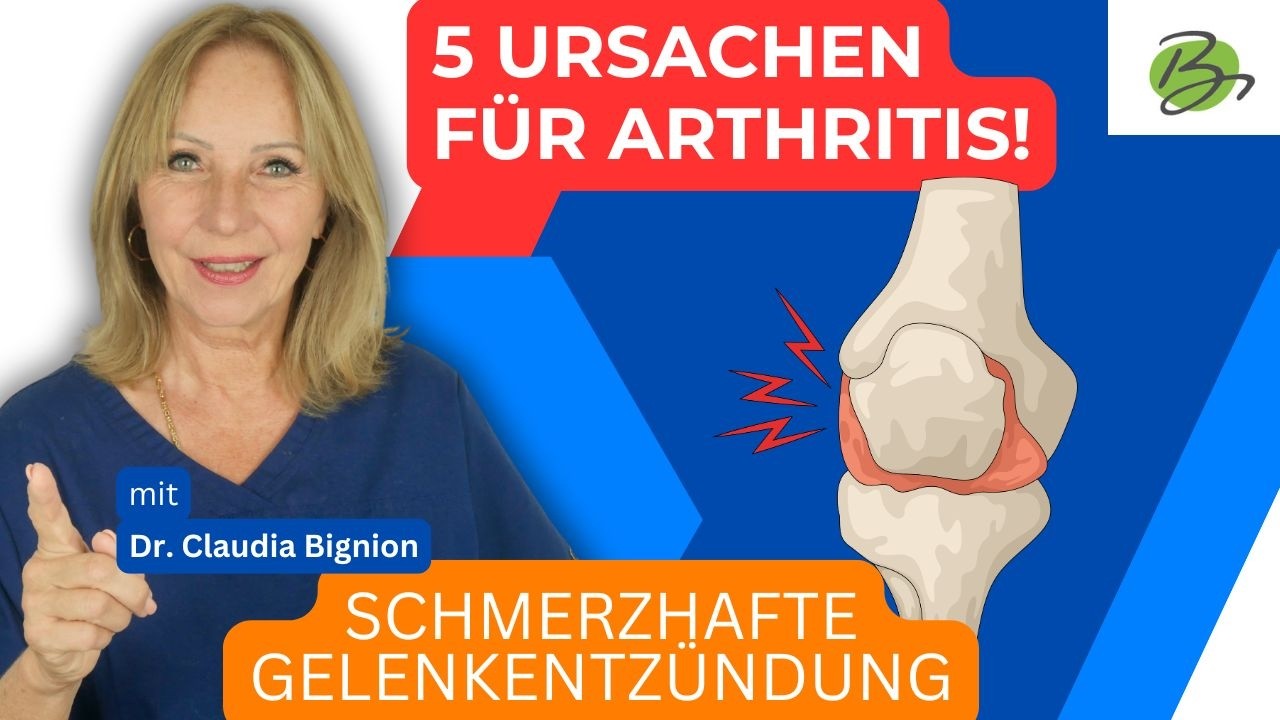 Arthritis: Woher kommt diese schmerzhafte Gelenkentz&uuml;ndung? (einfach erkl&auml;rt) | Dr. Claudia Bignion