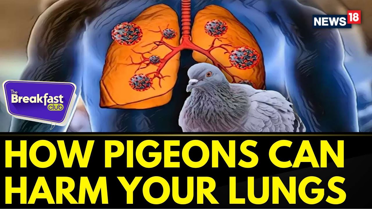 The Breakfast Club: Beware The Birds: How Pigeons Can Harm Your Lungs | Lung Diseases | News18