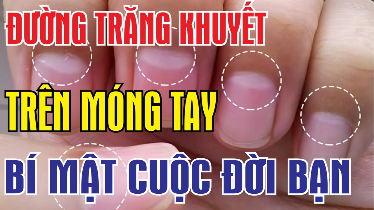 Bí Ẩn Đường Trăng Khuyết Trên Móng Tay – Dấu Hiệu Tiết Lộ Số Phận Của Bạn