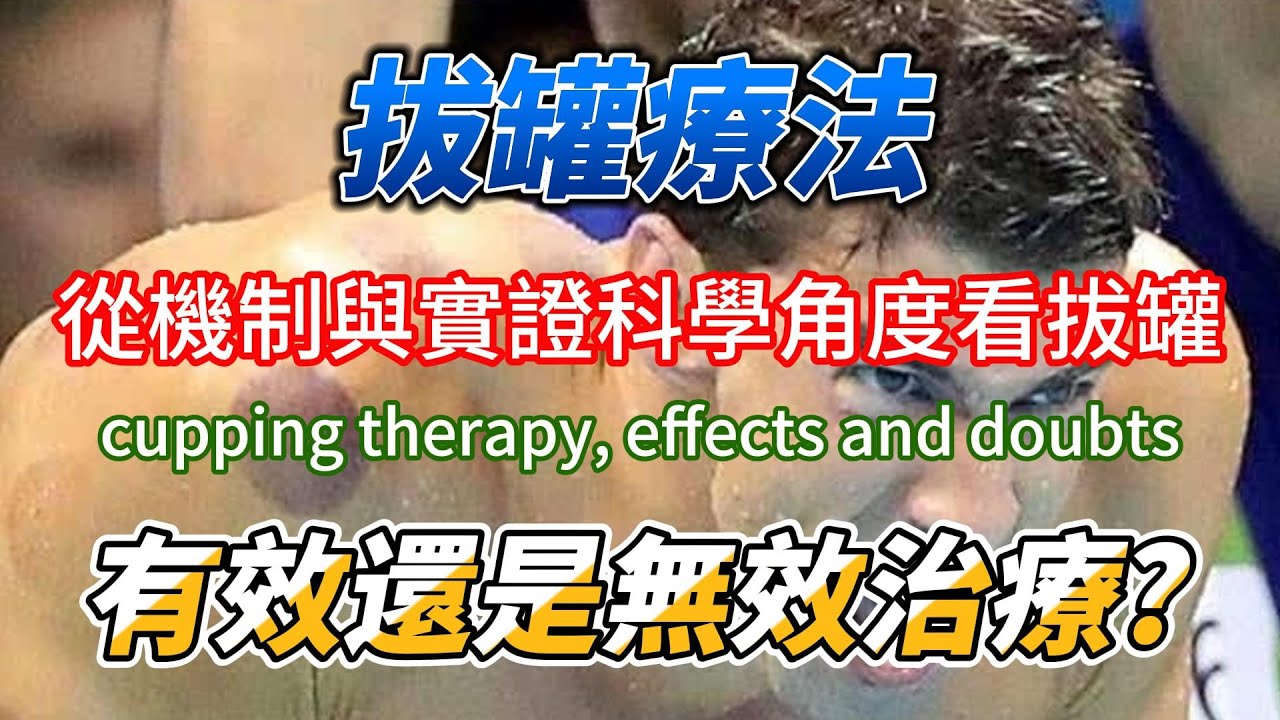 拔罐治療是真的有效還是無效療法? 對運動恢復有效果嗎? effects and doubts of cupping therapy