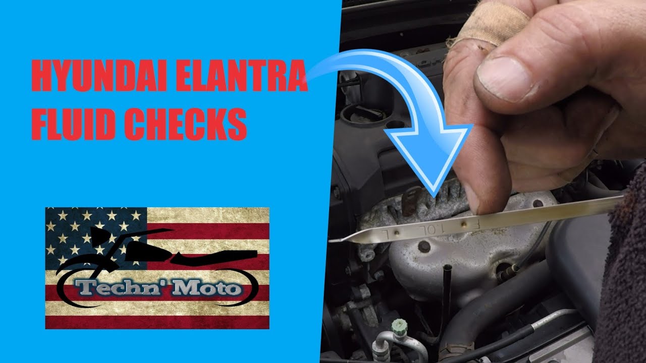 How to Perform Fluid Checks- 2009 Hyundai Elantra | Techn' Moto