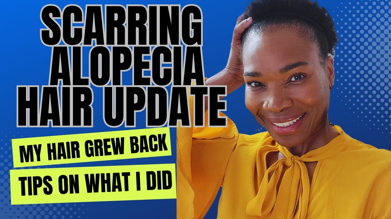 Scarring alopecia hair regrowth | life beyond hair