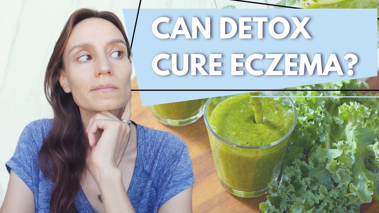Why DETOX If You Have Eczema