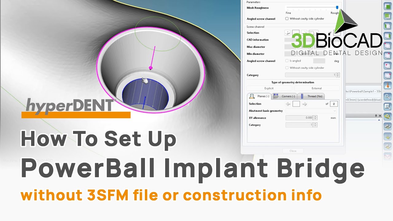 How To Set Up PowerBall Implant Bridge l FOLLOW-ME! hyperDENT l 3DBioCAD
