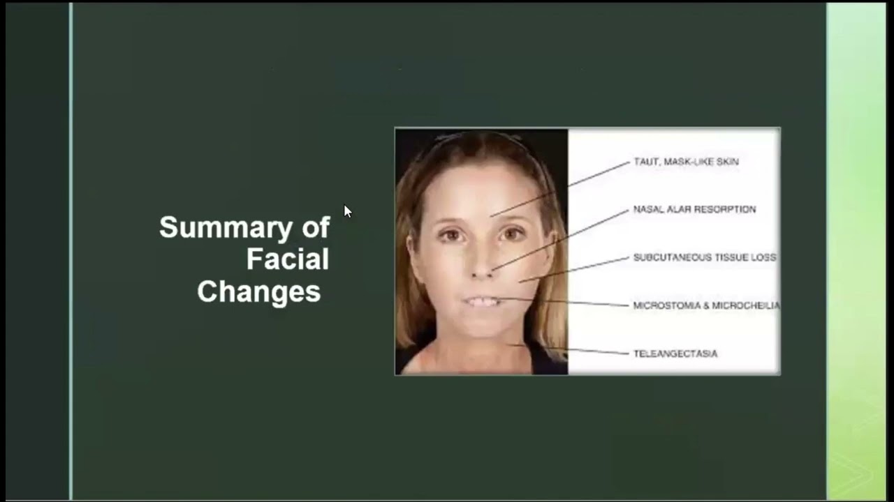 Cosmetic Procedures in Systemic Sclerosis, Heidi Jacobe, MD, MSCS