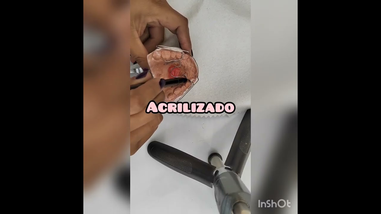 fabricación del aparato ortopédico biomator