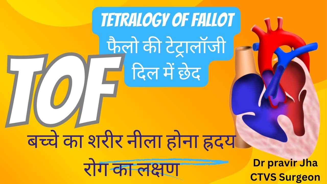 TOF | Tetralogy of Fallot | Boot Shaped Heart | सर्जरी कितनी जल्दी करवानी चाहिए? | Dr. Pravir Jha