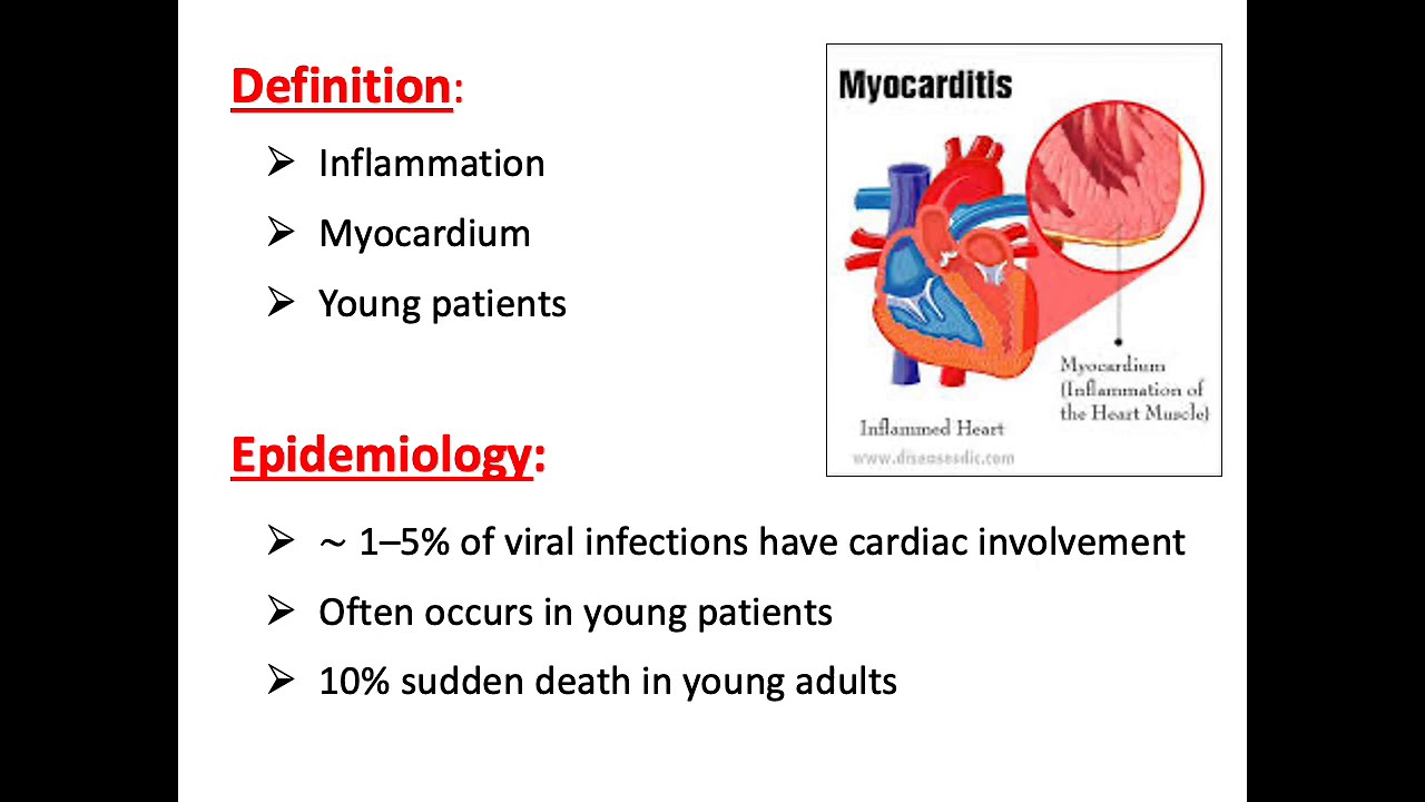 Micro CVS Block Viral Myocarditis/3 th grade