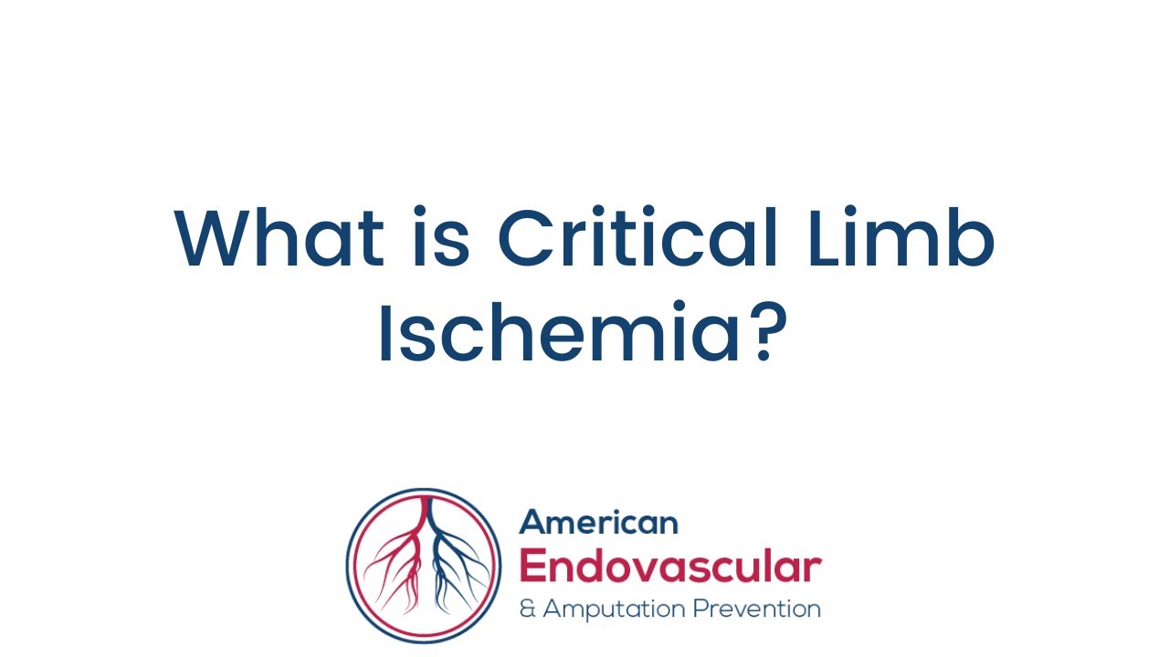 What is Critical Limb Ischemia?
