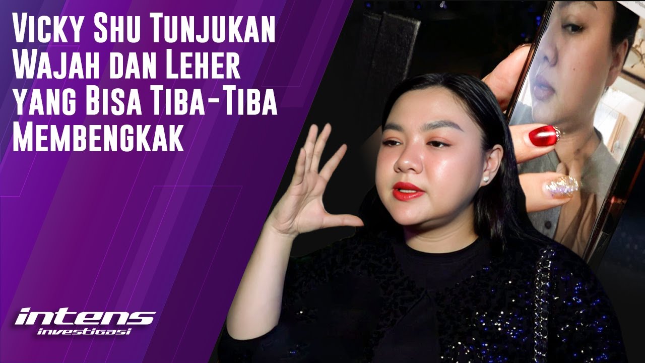 Vicky Shu Tunjukan Leher Dan Wajah&nbsp;Yang&nbsp;Membengkak