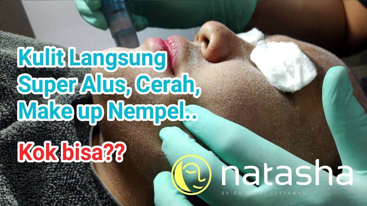 Microdermabrasi (Diamond Peeling) | On The Spot Natasha Skincare Sidoarjo
