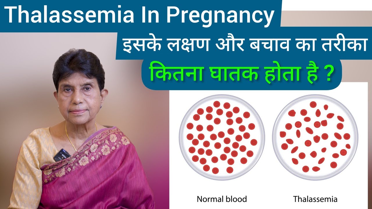 Thalassemia in Pregnancy in Hindi | क्या है Thalassemia इसके लक्षण और बचाव का तरीका