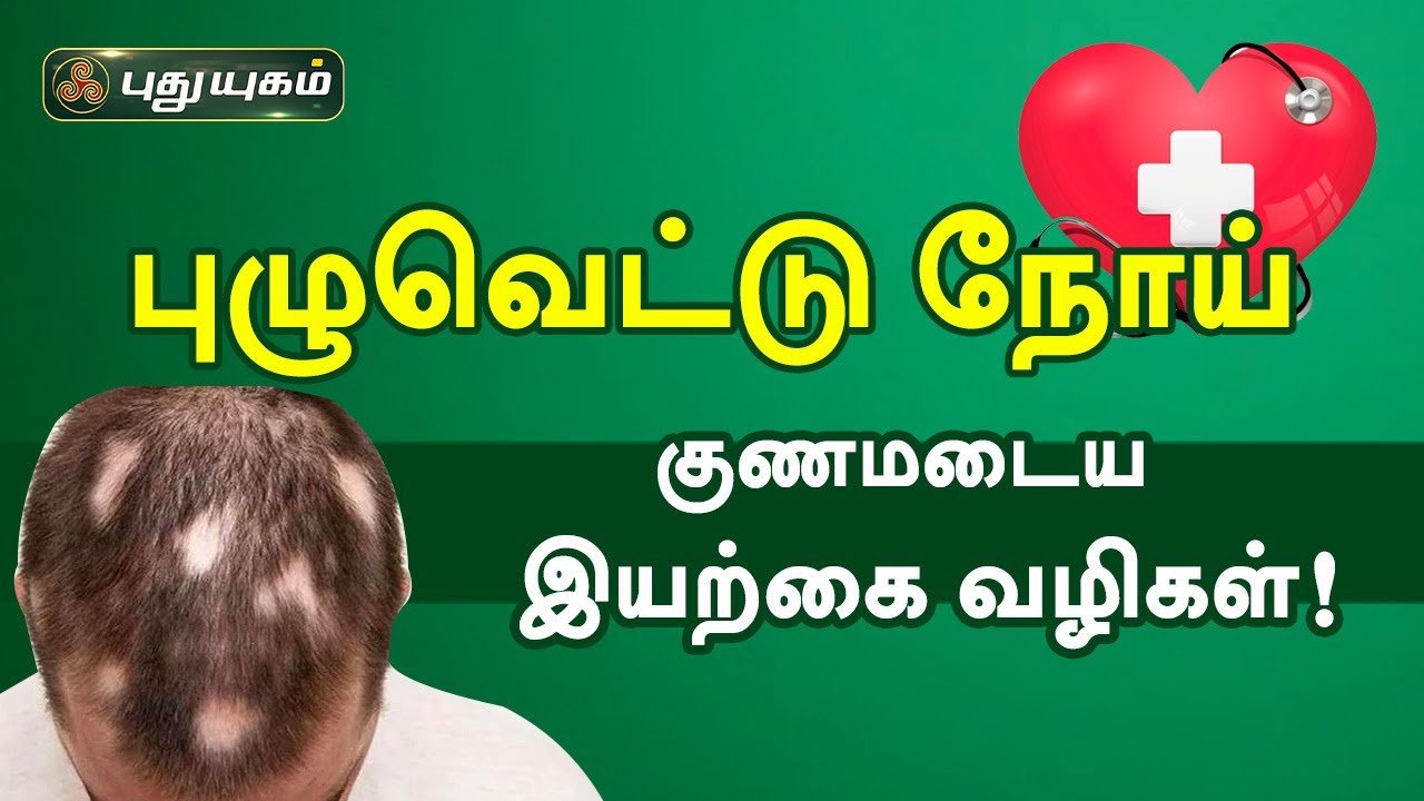 தலைமுடி புழுவெட்டு நோய் குணமாக! Alopecia Areata | Doctor On Call | PuthuyugamTV