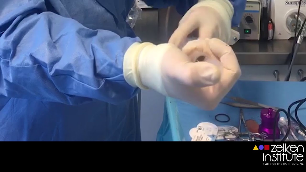 Tulip Nanofat Transfer Guide [ENGLISH] Dr Zelken Plastic Surgeon Newport Beach