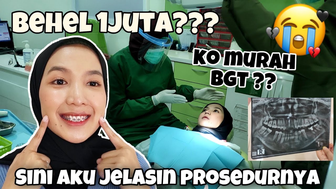 BEHEL STORY | Pengalaman Pasang Behel Gigi | Gimana sih rasanya ? Sakit banget #FDCDENTALCLINIC