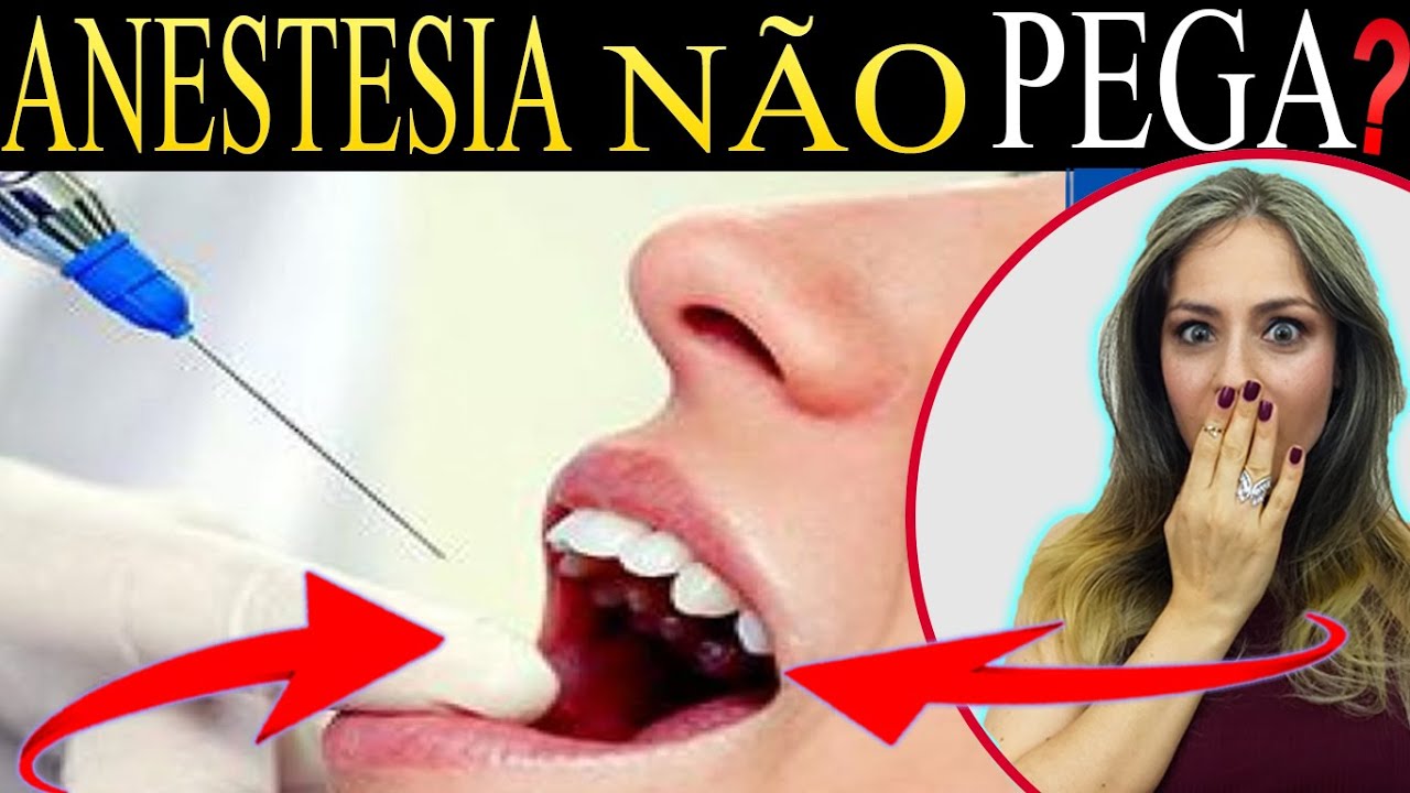 АНЕСТЕЗИЯ у стоматолога (НЕ Схватывает)?! Каждый раз, ко...