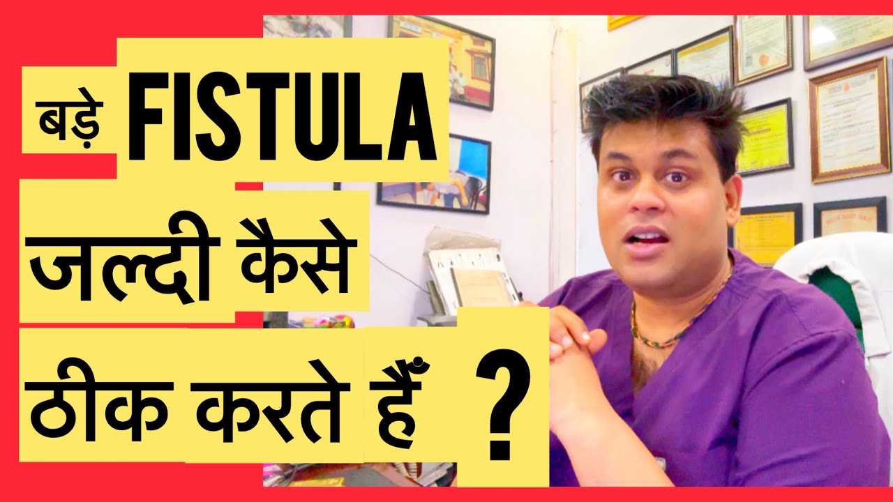 बड़े FISTULA जल्दी कैसे ठीक करते हैँ ?