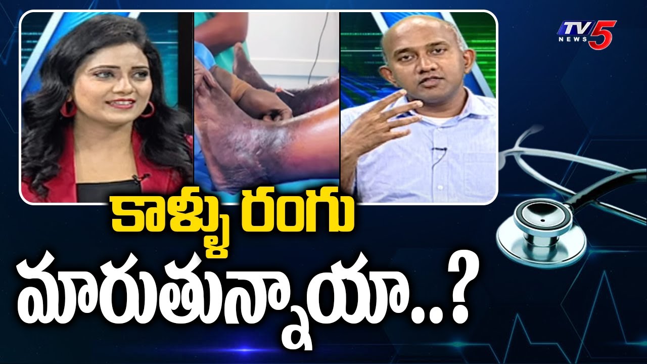 Health File: Varicose Veins Treatment In Hyderabad | Dr Raghav Sunil | Avis Hospital | TV5 News