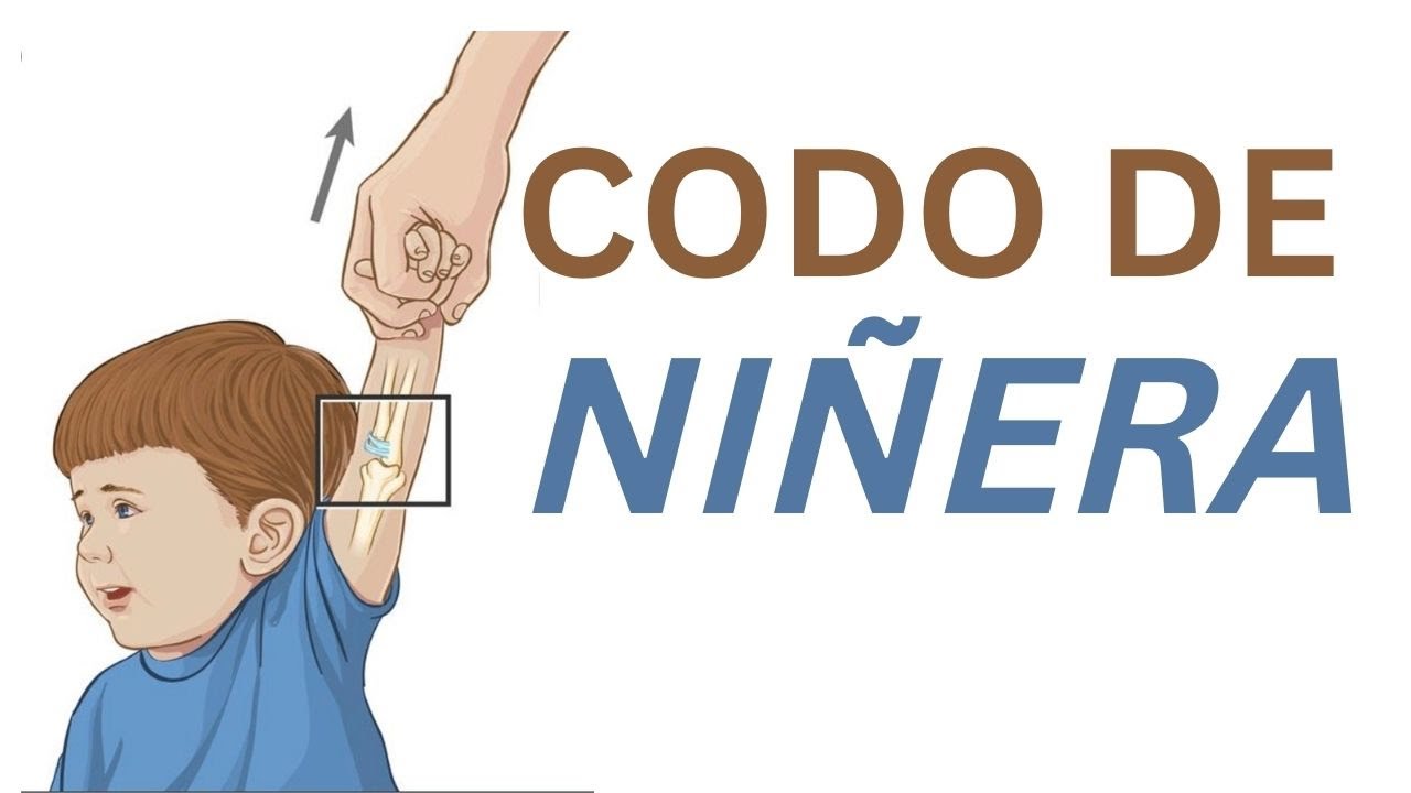 CODO DE NIÑERA  MANIOBRA DE REDUCCIÓN