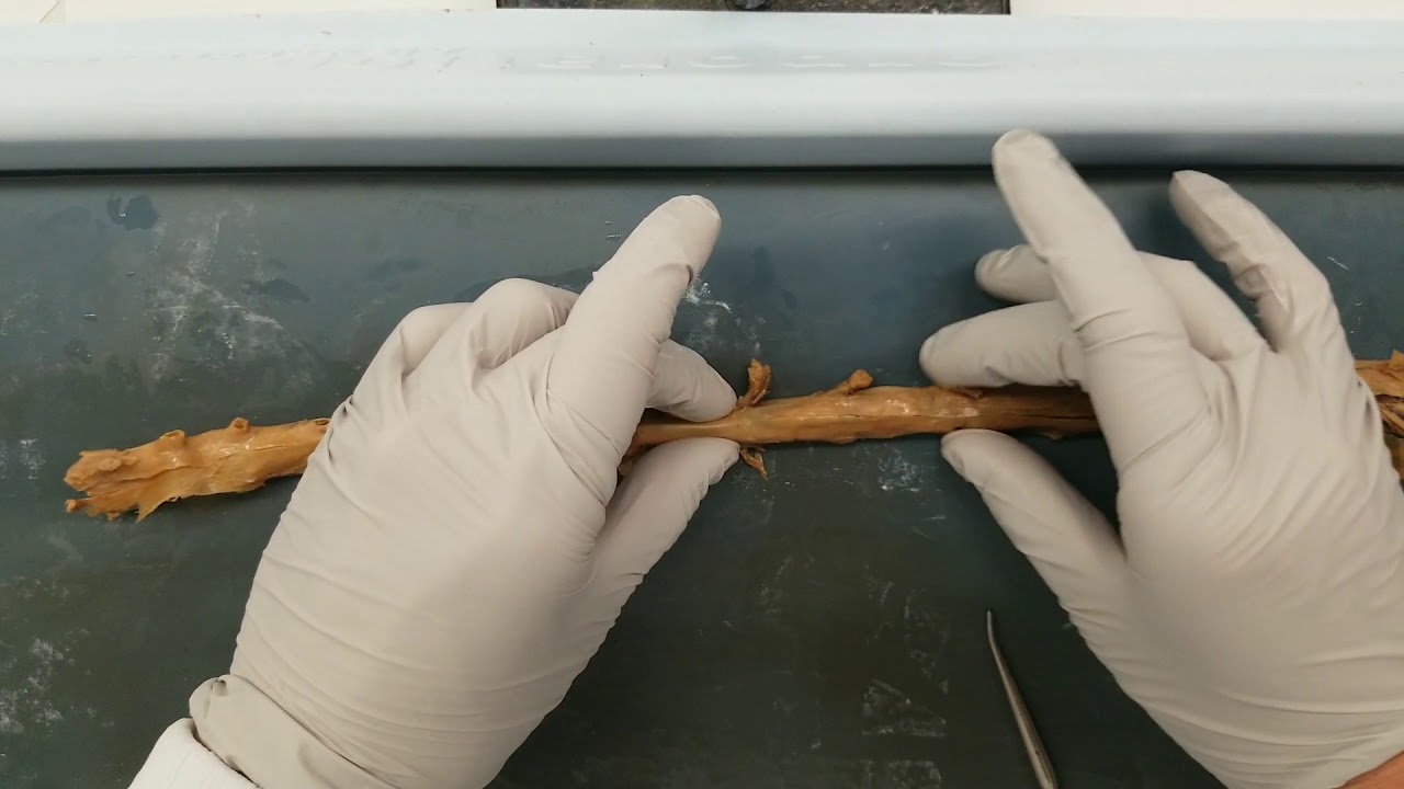 Spinal cord gross anatomy