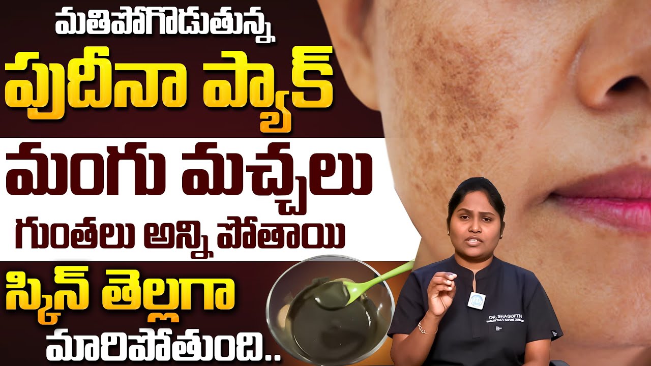 పుదీనా ప్యాక్  5 రోజుల్లో మీ పిగ్మెంటేషన్, నల్ల మచ్చలు అన్ని మాయం! | Remove Pigmentation | iDream