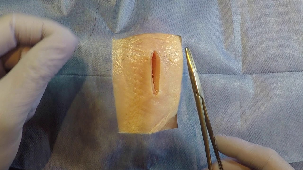 12. Suturas Cir&uacute;rgicas