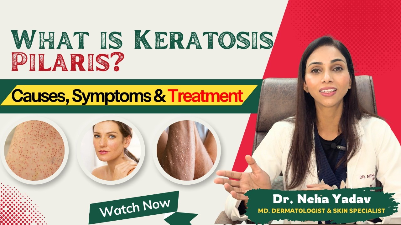 What is Keratosis Pilaris? | Strawberry Skin Causes, Symptoms & Treatment Explained in Hindi