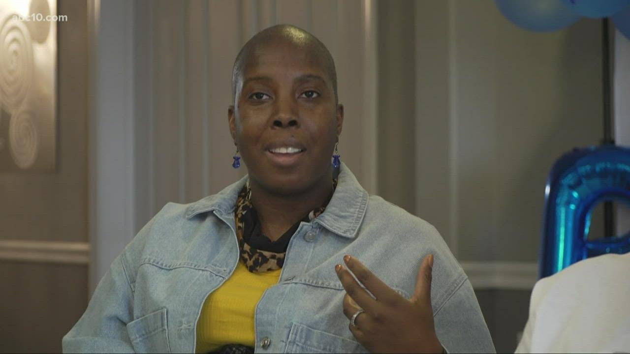 Fairfield-based Alopecia support group aims to raise awareness about the autoimmune disorder