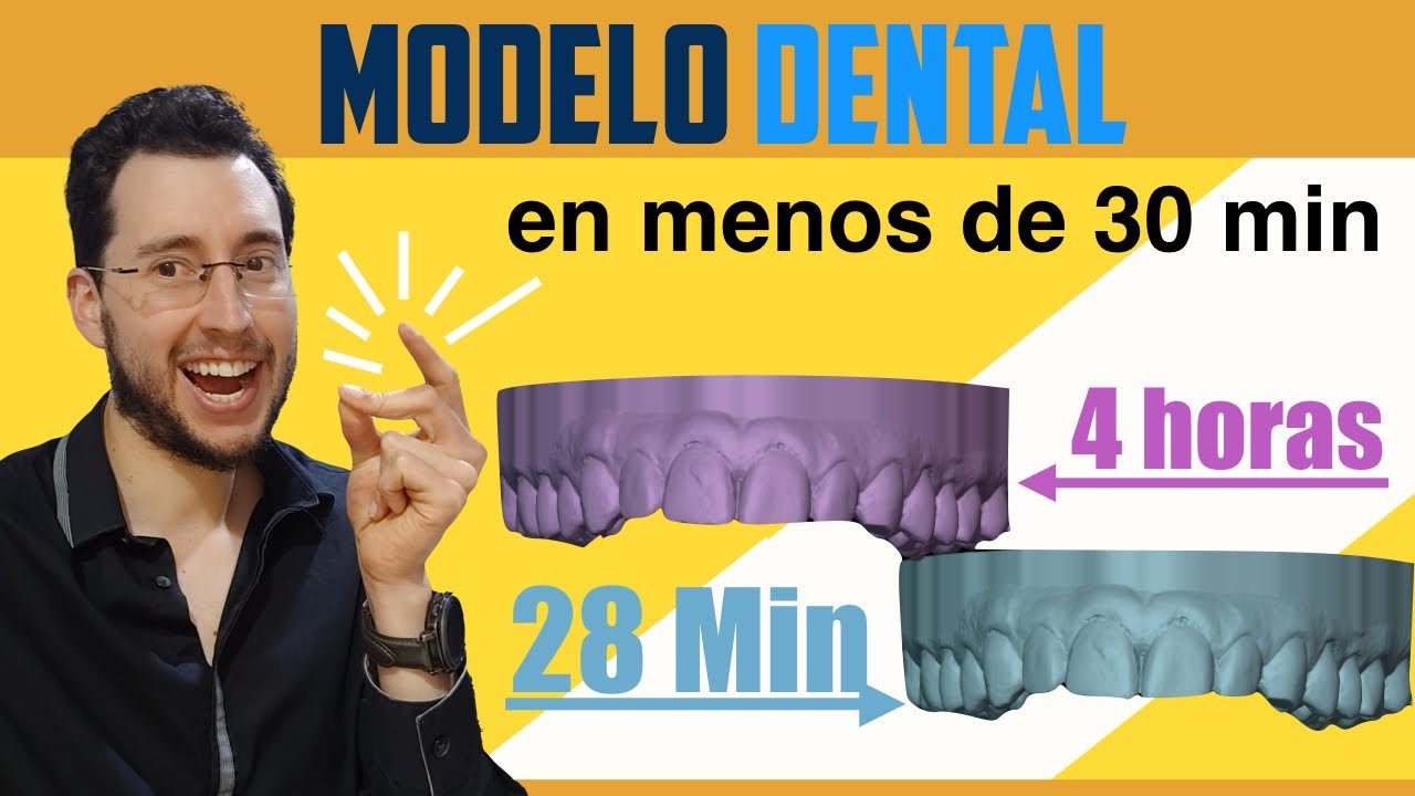 🚀 IMPRIMIR modelos dentales MUY RÁPIDO..! - Truco con Chitubox 👈