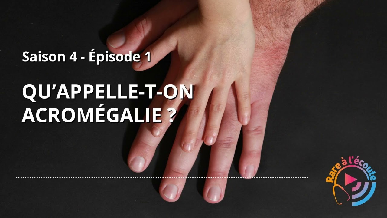 Maladie rare - Qu’appelle-t-on Acromégalie ?
