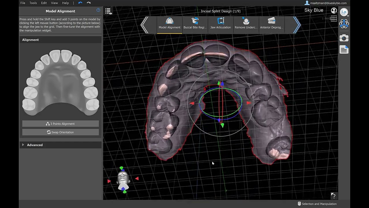 BSPV4.11: Creating a Splint With An Anterior Deprogrammer in BlueSkyPlan