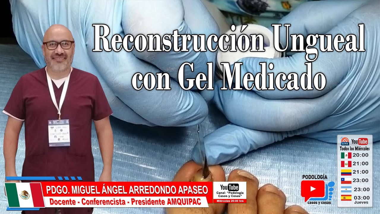 RECONSTRUCCIÓN  UNGUEAL CON GEL MEDICADO | Pdgo Miguel Ángel Arredondo | Podología Casos y Cosas