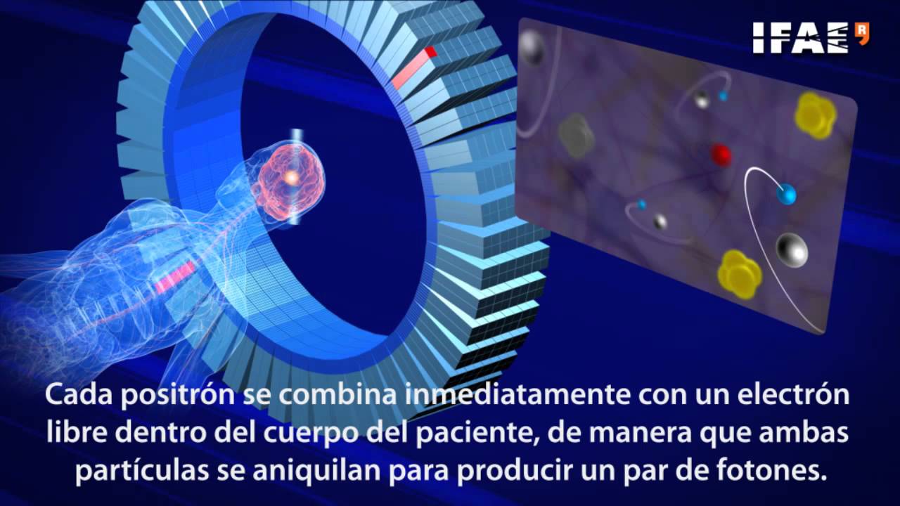 PET scanner (español)