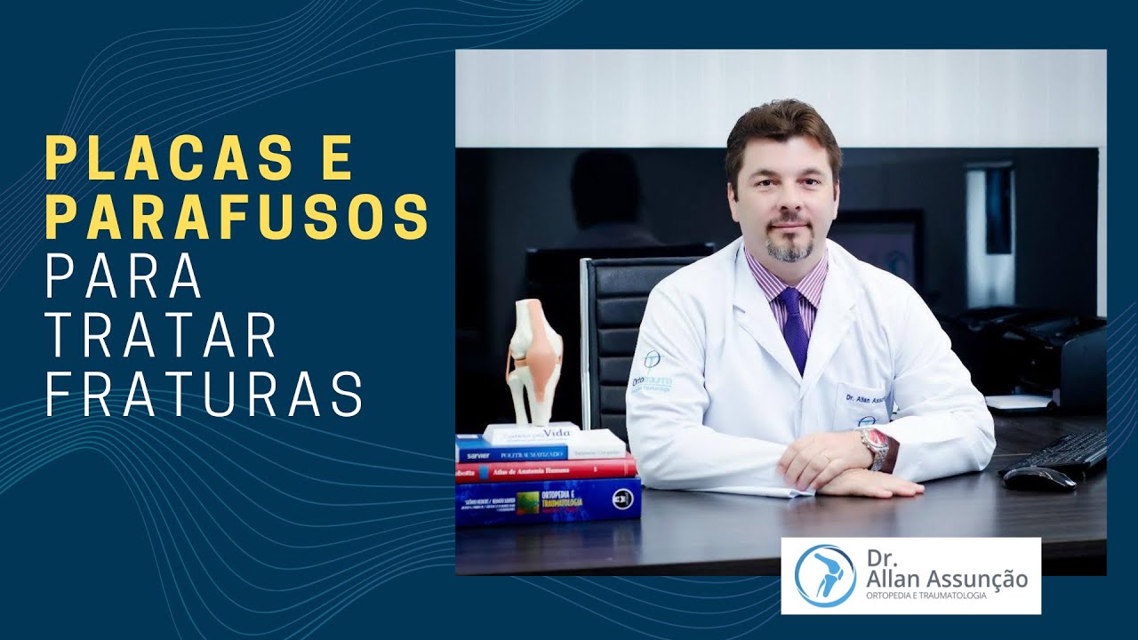 Por que é seguro e recomendado o uso de placas e parafusos para recuperar fraturas