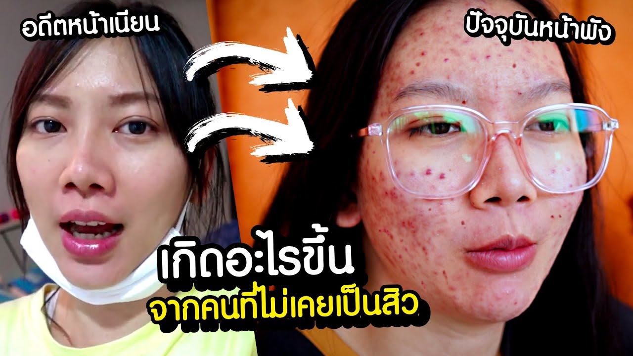 หนัาพังยับ!! ไปทำอะไรมาจะรักษาได้ไหม