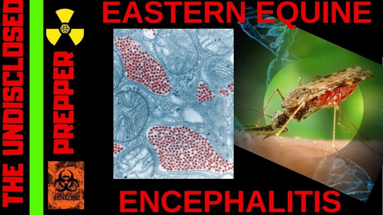 Eastern Equine Encephalitis - EEE Virus - Tripple E Virus - Sleeping Sickness