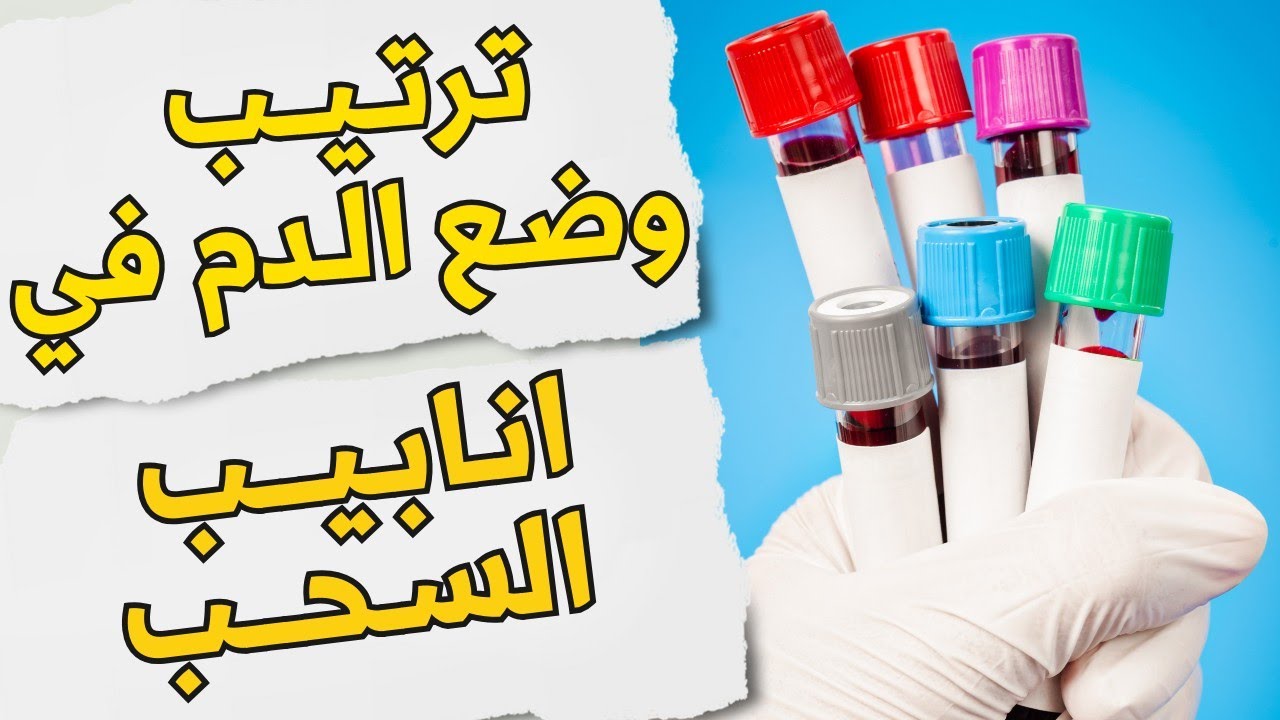 12_ما هو ترتيب وضع الدم في انابيب سحب عينات الدم ؟؟!!