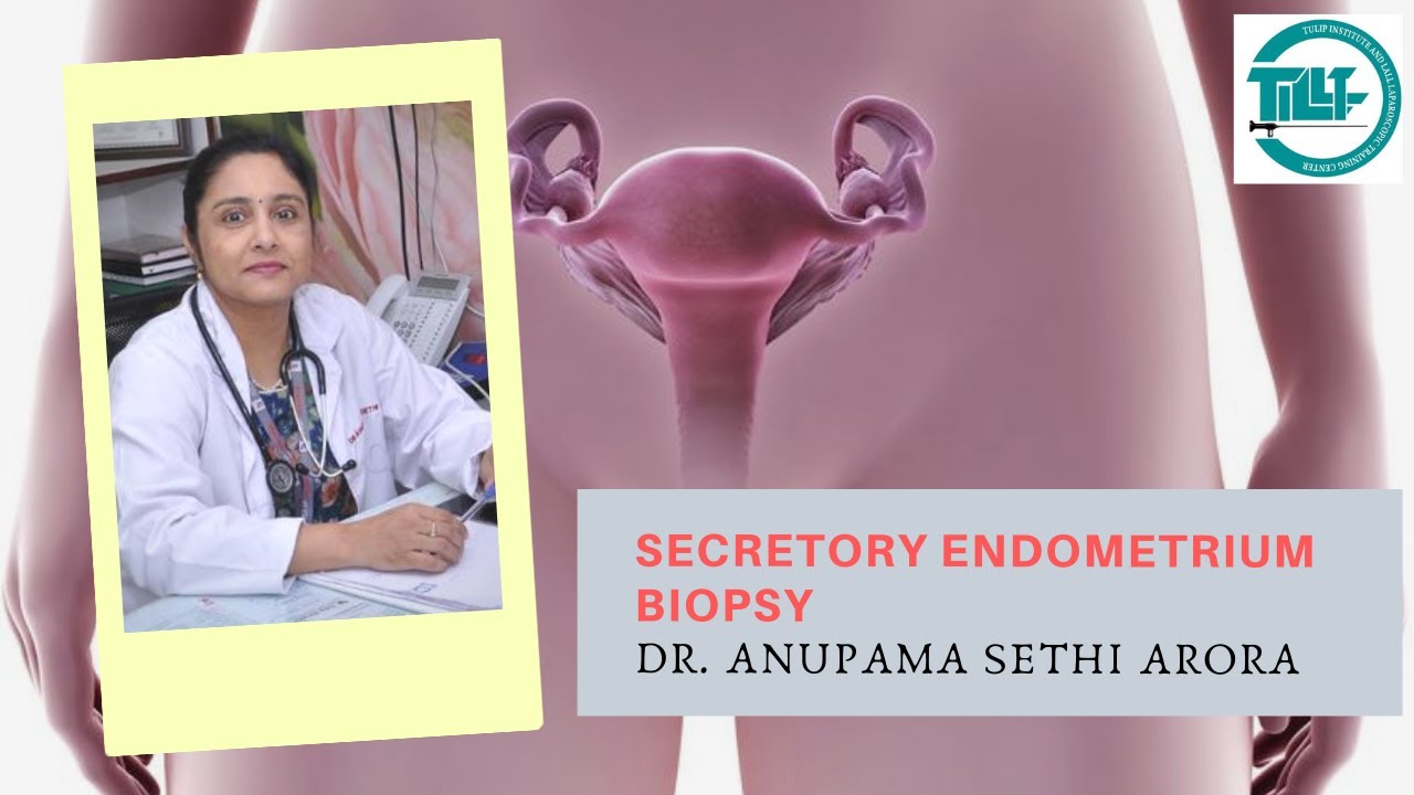 Secretory Endometrium Biopsy By Dr  Anupama Sethi Arora