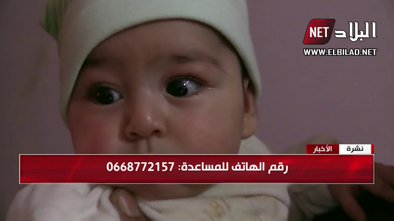 البويرة: طفل رضيع ببلدية سوق الخميس يعيش المعاناة بسبب مرض القلب