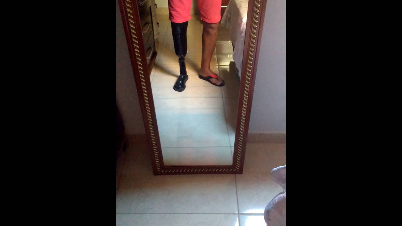Prótese transtibial (caseira), em fibra de vidro