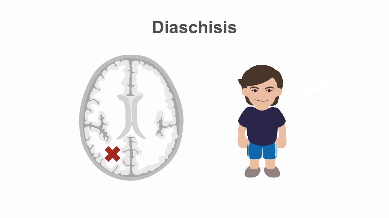 Occipital Lobes Overview: Lesions & Clinical Significance