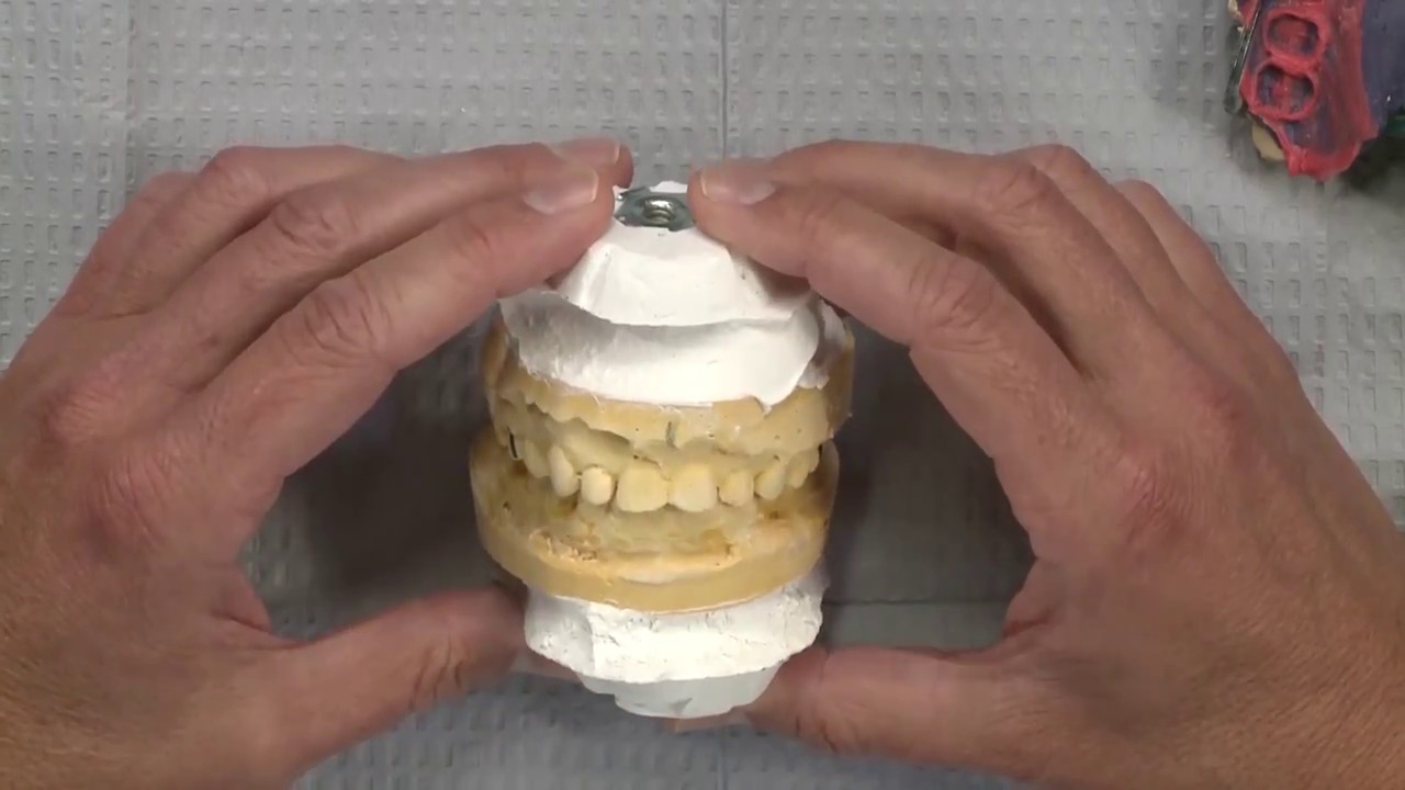 Case of the Week: Defend the Dimension … The Vertical Dimension!