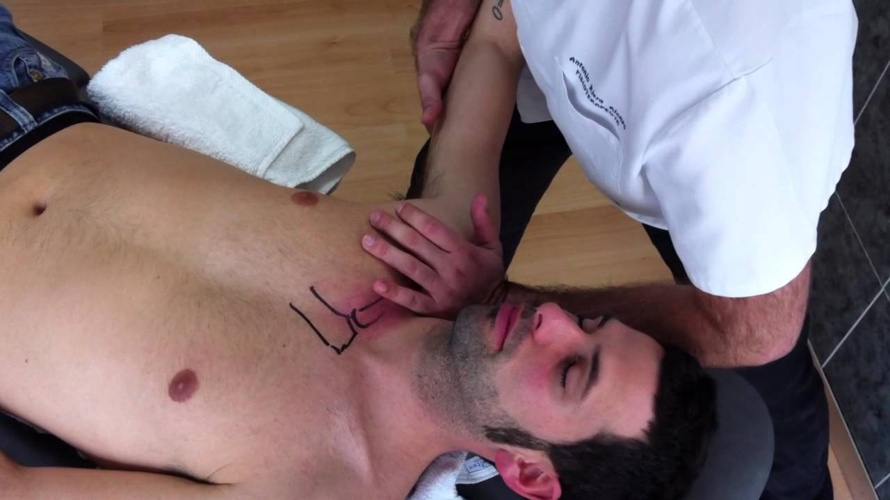 Osteopatía en la art. acromio-clavicular. Lesión en superioridad